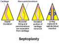 Types of Deviation of the Septum